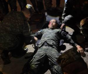 El soldado recibió atención médica en el lugar, pero fue trasladado hasta el Hospital Militar.