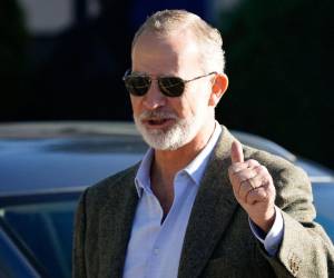 Su cirujano asegura que la recuperación es rápida. Solo necesitará unas gotas, gafas de sol y evitar esfuerzos bruscos durante unos días.