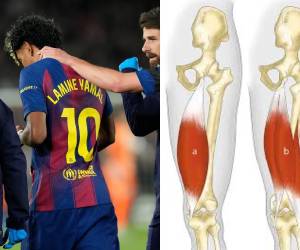 Toda España en alerta de cara al Mundial 2026, luego de que Lamine Yamal saliera lesionados a 50 días de la justa. Lo que se sabe de sus afectación.