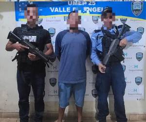 El sospechoso fue detenido luego de que le arrancara la oreja a un hombre en Valle de Ángeles.