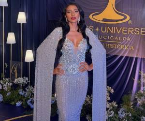 La investigación por la muerte de Wualys Fuentes Aquino, virreina de Miss Universo Tegucigalpa 2026, continúa en manos de Medicina Forense, donde uno de los estudios que podría ser determinante para esclarecer el caso es la histopatología, un examen especializado que permitirá conocer si existía alguna alteración en los tejidos de la joven antes de su fallecimiento.
