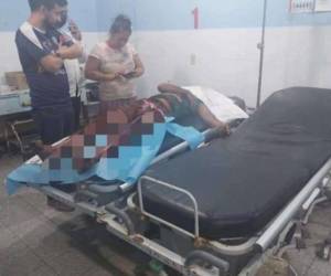 El defensor de derechos humanos Omar Cruz Tomé y su suegro Andy Martínez fallecieron en el hospital de Tocoa.