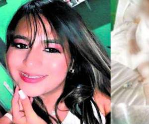 Hazel Michell hace un mes fue atropellada junto a su amigo Ariel Girón por su expareja, Fabricio Matute Cabrera.