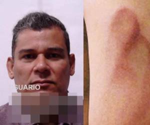 El Ministerio Público dio a conocer que La Fiscalía Especial de Protección a la Niñez y Adolescencia (FEP-NIÑEZ), dictó una sentencia condenatoria para un médico hondureño que golpeó al novio de su hija, quien era menor de edad.