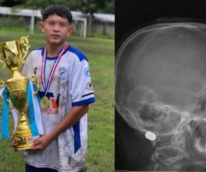 Emerson Isaac Díaz Villanueva, un menor de 14 años, habría muerto tras recibir el impacto de una bala perdida en la comunidad de Coalaca Las Flores, en el departamento de Lempira. Aquí los detalles: