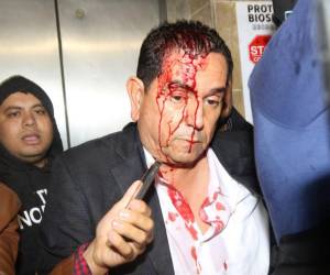 El diputado nacionalista Antonio Rivera Callejas sufrió lesiones en su cabeza al ser agredido por una turba de Libre.