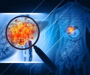 Somos lo que comemos, no espere que su cuerpo reaccione de la mejor manera si usted con su estilo de vida lo lleva al límite de sus capacidades.