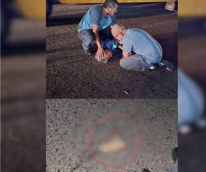 Una señora de la tercera edad perdió su pie tras ser atropellada por un motociclista. La adulta mayor quedó tendida en el pavimento.