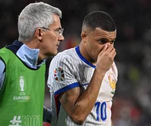 Mbappé se rompió la nariz en el duelo de Francia ante Austria.