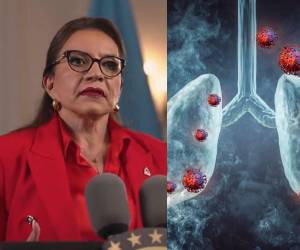 La presidenta Xiomara Castro fue diagnosticada con bronquitis aguda y le recomendaron tres días de reposo en medio de la contaminación del aire que afecta Tegucigalpa y otras partes de Honduras. Te contamos en la siguiente galería que es la bronquitis aguda, sus síntomas y repercusiones.