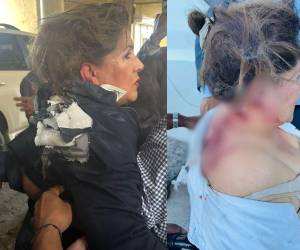 Acostada en una camilla, a la espera de los resultados médicos y de una segunda evaluación, se encuentra la diputada nacionalista Gladis López, quien fue atacada con un artefacto explosivo cuando se disponía a ingresar al Congreso Nacional (CN). Esto dijo sobre su estado de salud: