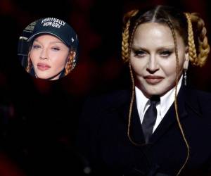 “Ahora que la hinchazón de la cirugía ha bajado”: Madonna se burló de su aspecto “irreconocible” en los premios Grammy.
