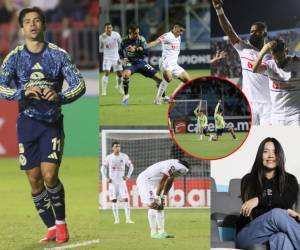 Olimpia cayó este martes por marcador de 1-2 ante el América de México en Concacaf Champions Cup. Te mostramos las mejores imágenes del juego.