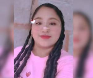 Pese a varios días de lucha en la camilla del principal centro asistencial del país, se confirmó la muerte de Erika Yojana Torres.