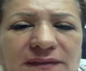 López sufrió lesiones en la espalda y la cabeza, por lo que fue trasladada de emergencia a un centro asistencial para recibir atención médica.