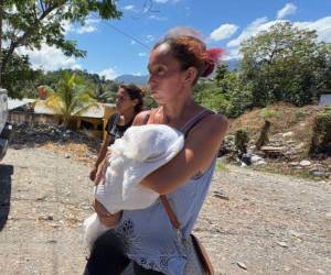 Una bebé de seis meses de edad murió la madrugada del pasado sábado 11 de abril en La Ceiba. Fotografías de la menor muestran que presentaba sarpullido o moretones en su cuerpo. ¿Qué se sabe del caso?