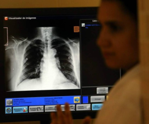 La máquina de rayos X fue comprada con los fondos de la Secretaría de Salud a principios de año.