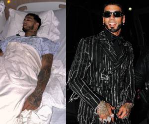 En la cama de un hospital, con el oxígeno puesto, y una vía en uno de sus brazos se encuentra el artista.