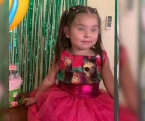 Una menor identificada como Eliana Lizeth López perdió la vida en un accidente en la comunidad de Buena Vista, municipio de Jutiapa, departamento de Atlántida.