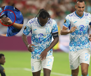 Al ex Boavista de Portugal se le rodaron las lágrimas al momento de quebrarse el brazo.