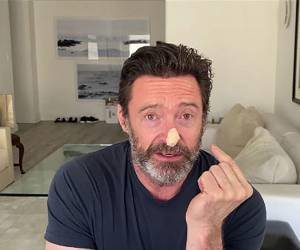 En las imágenes se puede ver al histrión con un pequeño apósito en la nariz.