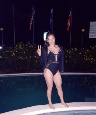 Famosas hondureñas que admitieron públicamente someterse a una cirugía plástica