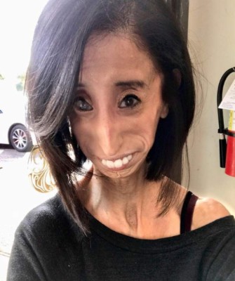 La inspiradora historia detrás de Lizzie Velásquez, la 'mujer más fea del mundo'