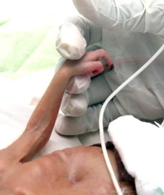 Murió bebé prematuro tras cuatro días de valiente lucha