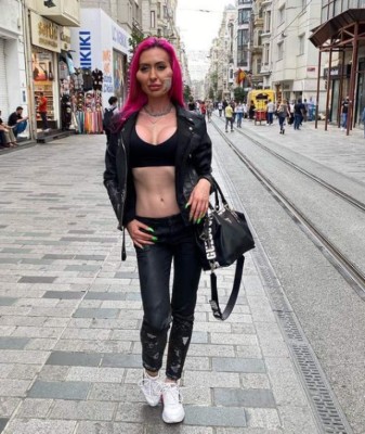 Anastasia Pokreshchuk, la mujer con los pómulos más grandes del mundo (FOTOS)