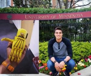 Melvin Cruz realizó la pasantía en la Univesidad de Minnesota a principios del 2016 pero sus ideas de las prótesis inician a finales del 2015