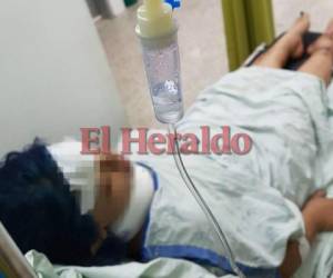 Nicolle si bien no tiene fracturas en ambas piernas, las mismas están inflamadas y se mantiene bajo cobertura de analgésicos y antiinflamatorios. (Foto cortesía: Hospital Escuela/ El Heraldo Honduras, Noticias de Honduras)