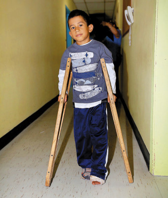 Osteogénesis, drama que viven 500 niños hondureños