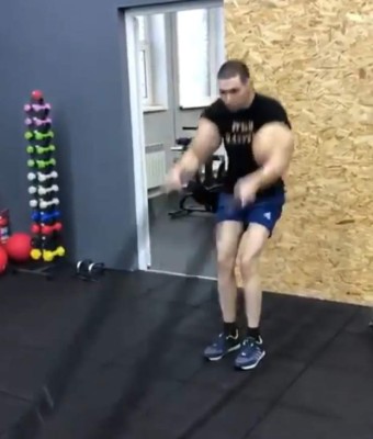 El antes y después del 'Popeye' que se inyectó aceite en los músculos