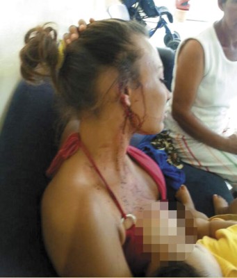 Salvaje hombre le cercena una oreja a su exesposa