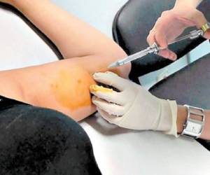 70 mujeres se han aplicado el implante, según la jefa de la sala de ginecología del Hospital Escuela Universitario.