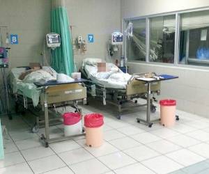 Dos pacientes quemados permanecen en cuidados intensivos en el IHSS. (Foto: Marcel Osorto)