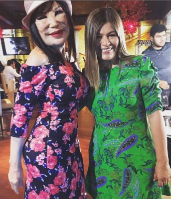 FOTOS: Así era Lyn May antes de ser inyectada con aceite en el rostro