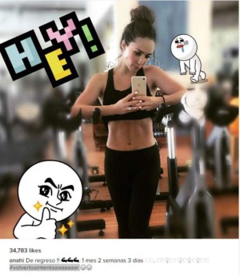 Nueva fotografía de Anahí despierta los rumores de una cirugía estética en los labios