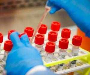 Un técnico prepara muestras de un paciente de COVID-19 para análisis en un laboratorio en Long Island, Nueva York. Foto AP.
