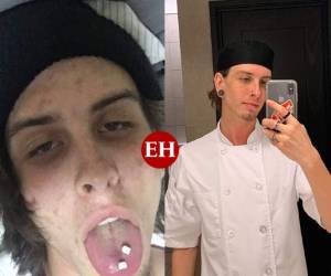 Travis, un usuario de Reddit, publicó imáganes del antes y el después de estar sumido en problemas de drogadicción tras más de dos años de abstinencia.