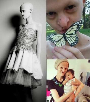 Modelo con inusual apariencia rompe estereotipos de belleza