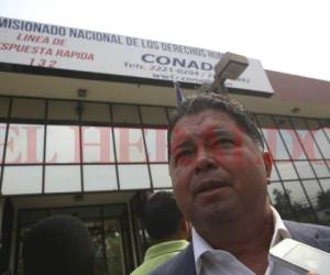 El exdirector de la Policía Nacional, Ramón Sabillón, interpuso una denuncia este martes ante el Comisionado Nacional de Derechos Humanos (Conadeh) por supuestas amenazas.