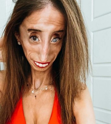 La inspiradora historia detrás de Lizzie Velásquez, la 'mujer más fea del mundo'