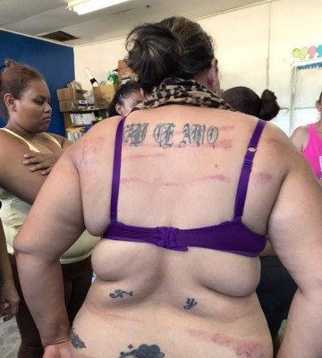 Centro de Prevención de Tortura condena acciones en cárcel de El Progreso