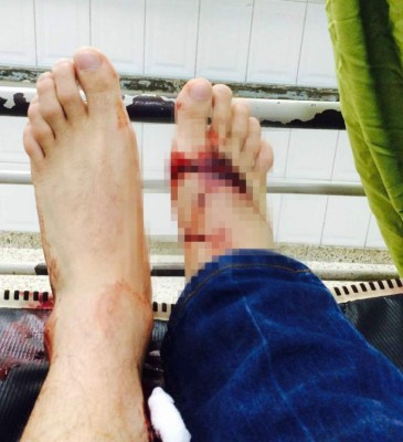 Un muerto y cinco heridos en tiroteo frente al Saúl Zelaya