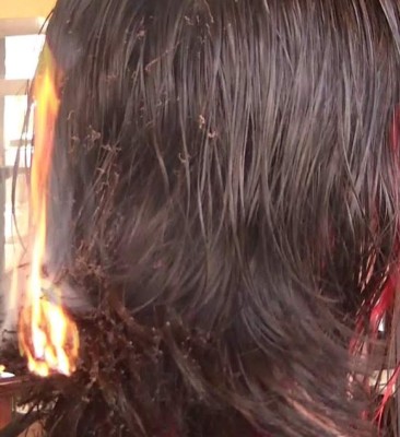 Le queman el pelo