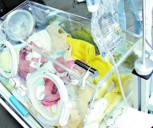 Las pequeñas siamesas fueron llevadas ayer a un centro de imágenes privado para realizar los estudios.