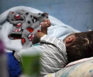 Tiene tres años y un historial de más de 30 intervenciones quirúrgicas.