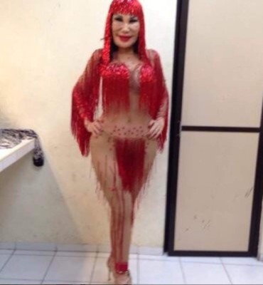 FOTOS: Así era Lyn May antes de ser inyectada con aceite en el rostro