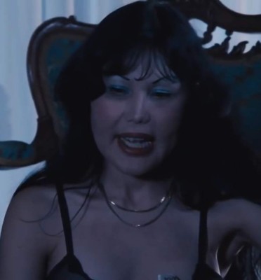 FOTOS: Así era Lyn May antes de ser inyectada con aceite en el rostro